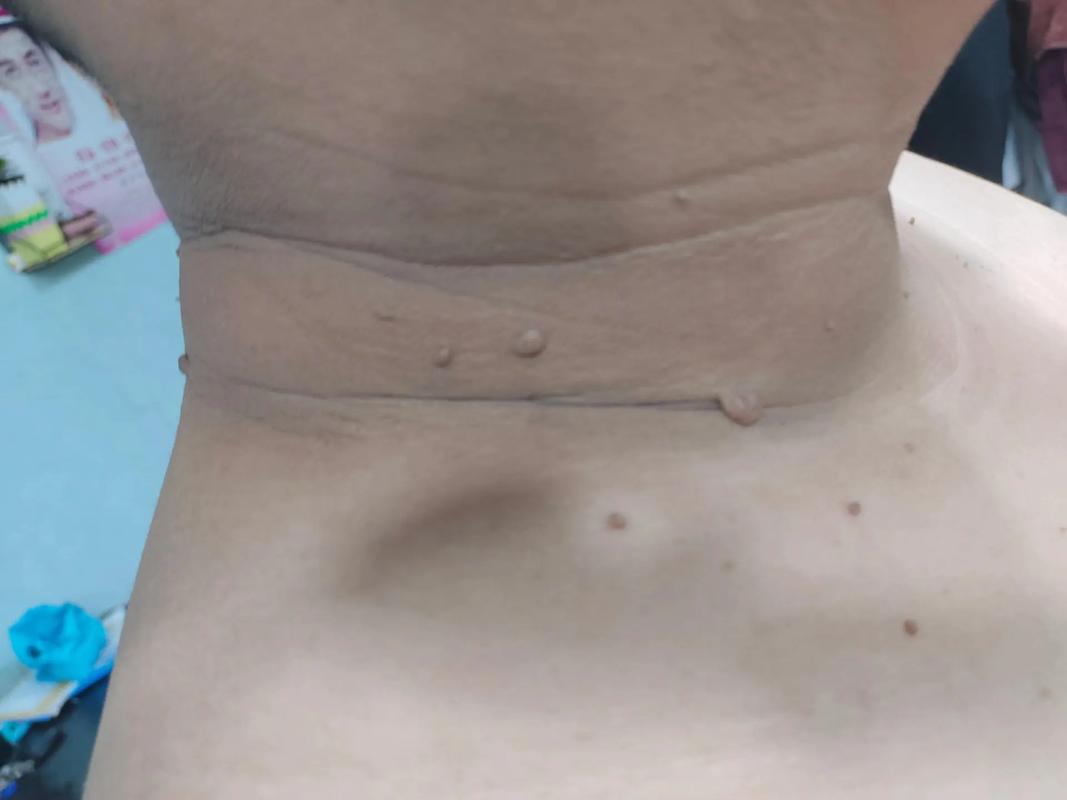 无限火力猴子出装_LOL无限火力猴子出装攻略